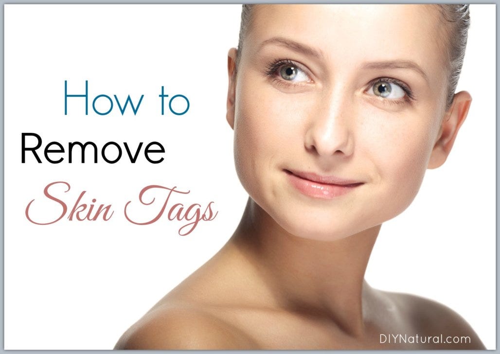 Essence Skin Tag Remover Today for a special discount!! | by