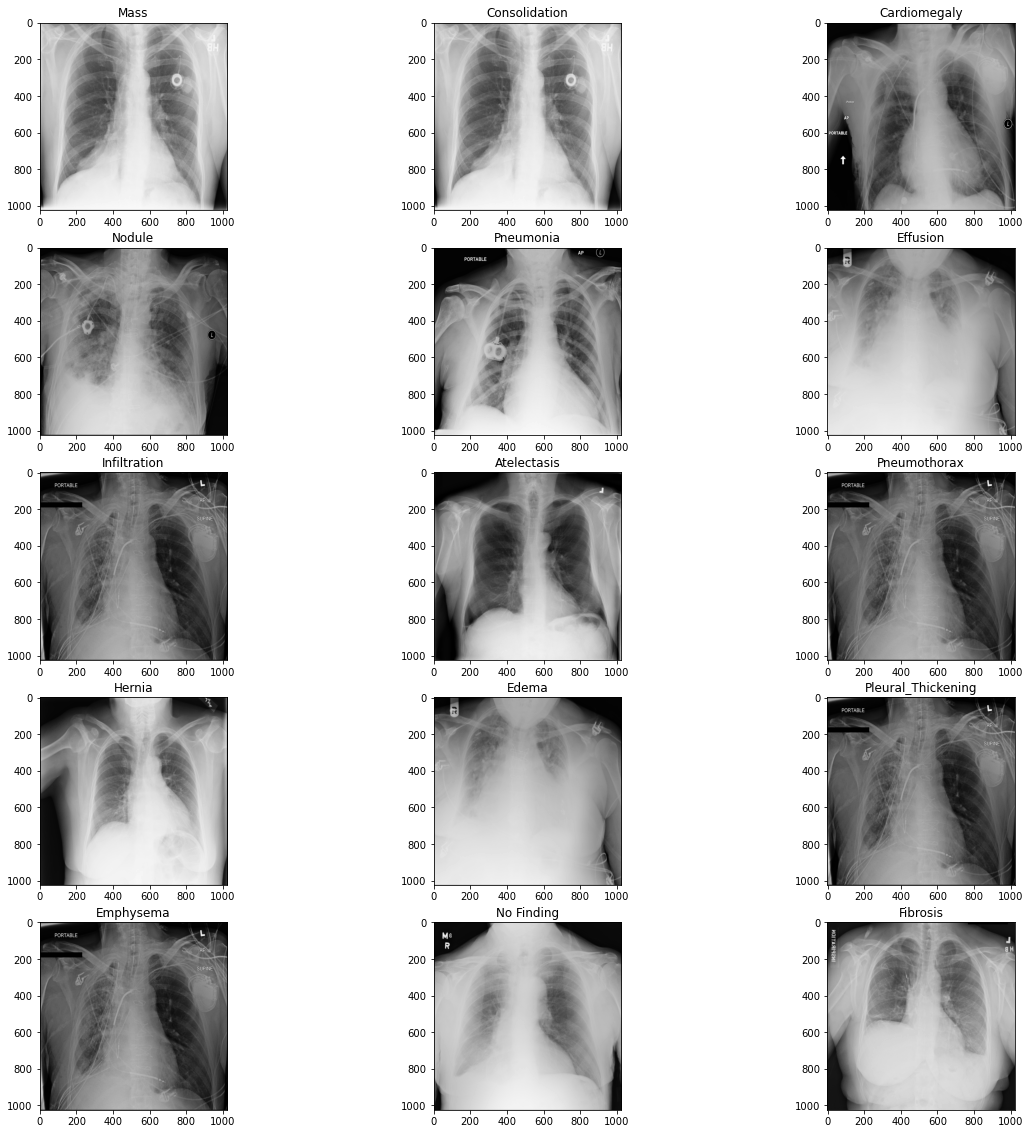 Using Artificial Intelligence to Screen and diagnose Chest Xrays Medium