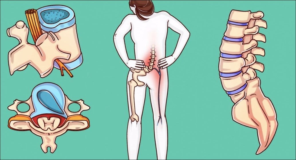 A Surgeon Reveals Exercises That Can Heal Your Spine Before It’s Too Late