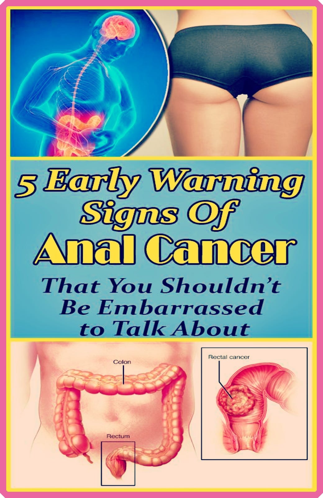 5 Early Warning Signs Of Anal Cancer That You Shouldnt Be Embarrassed