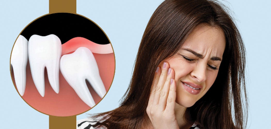 Wisdom Tooth Pain Relief: Remedies That Actually Help