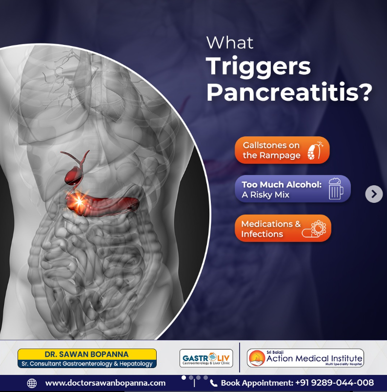 pancreas specialist doctor in North Delhi