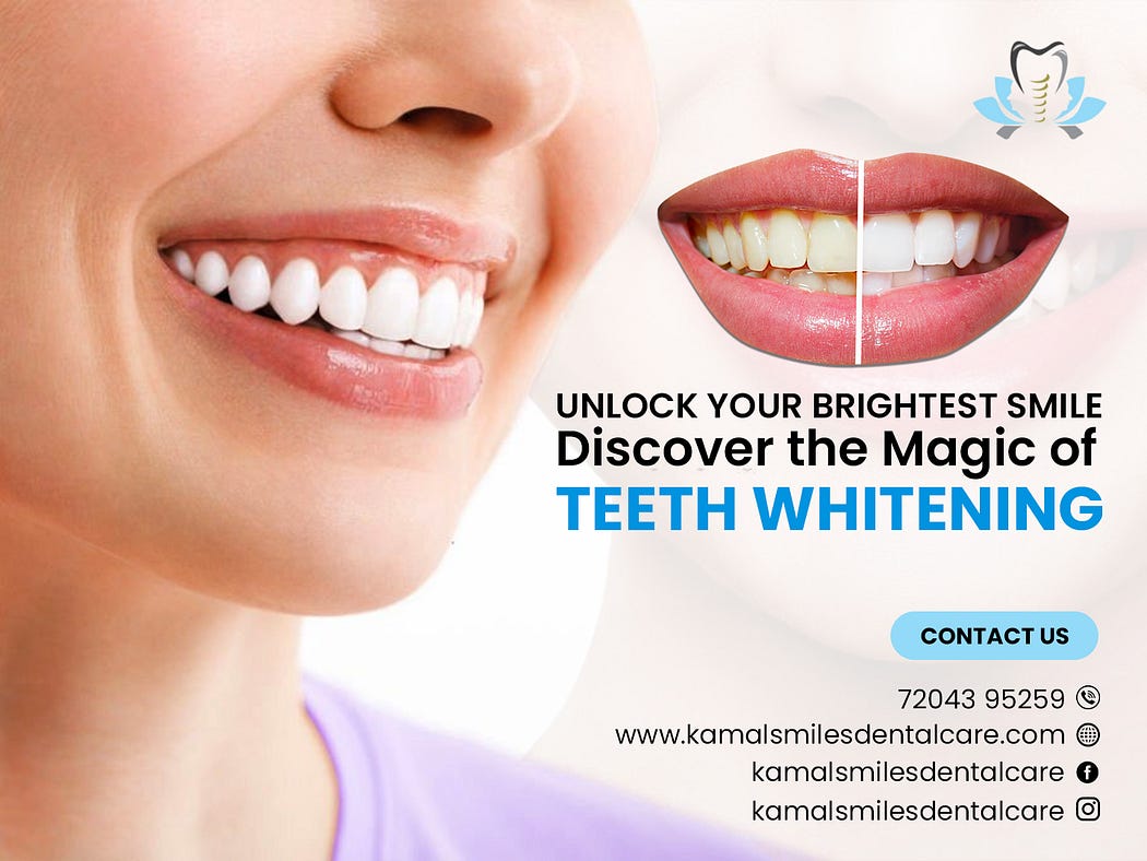 Tooth Whitening