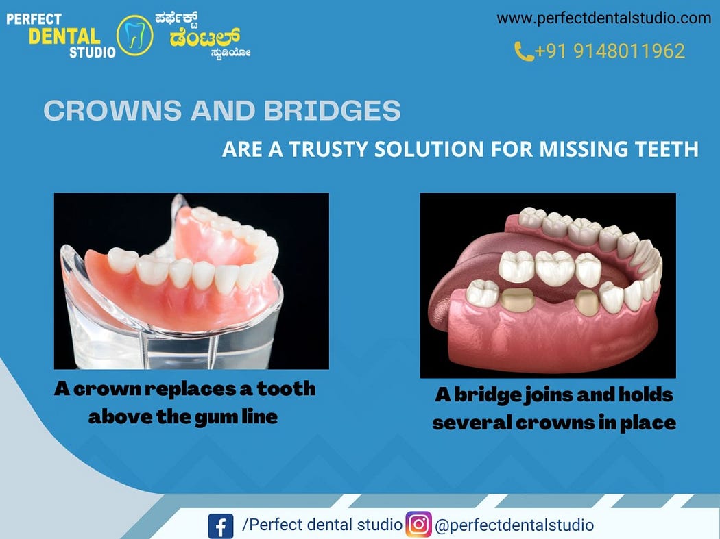 Crowns and Braces