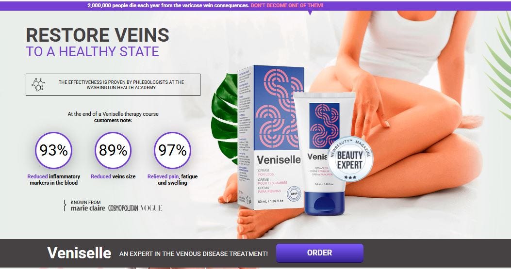 What are varicose veins?