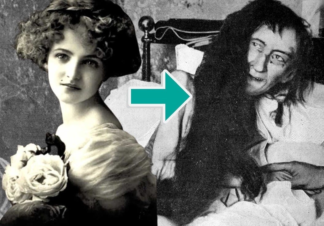 She Was Locked in a Dark Room for 25 Years — Because She Wanted to Marry the Wrong Man