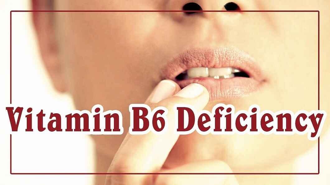 Vitamin B6 Deficiency Causes, Symptoms, Treatment, and Prevention