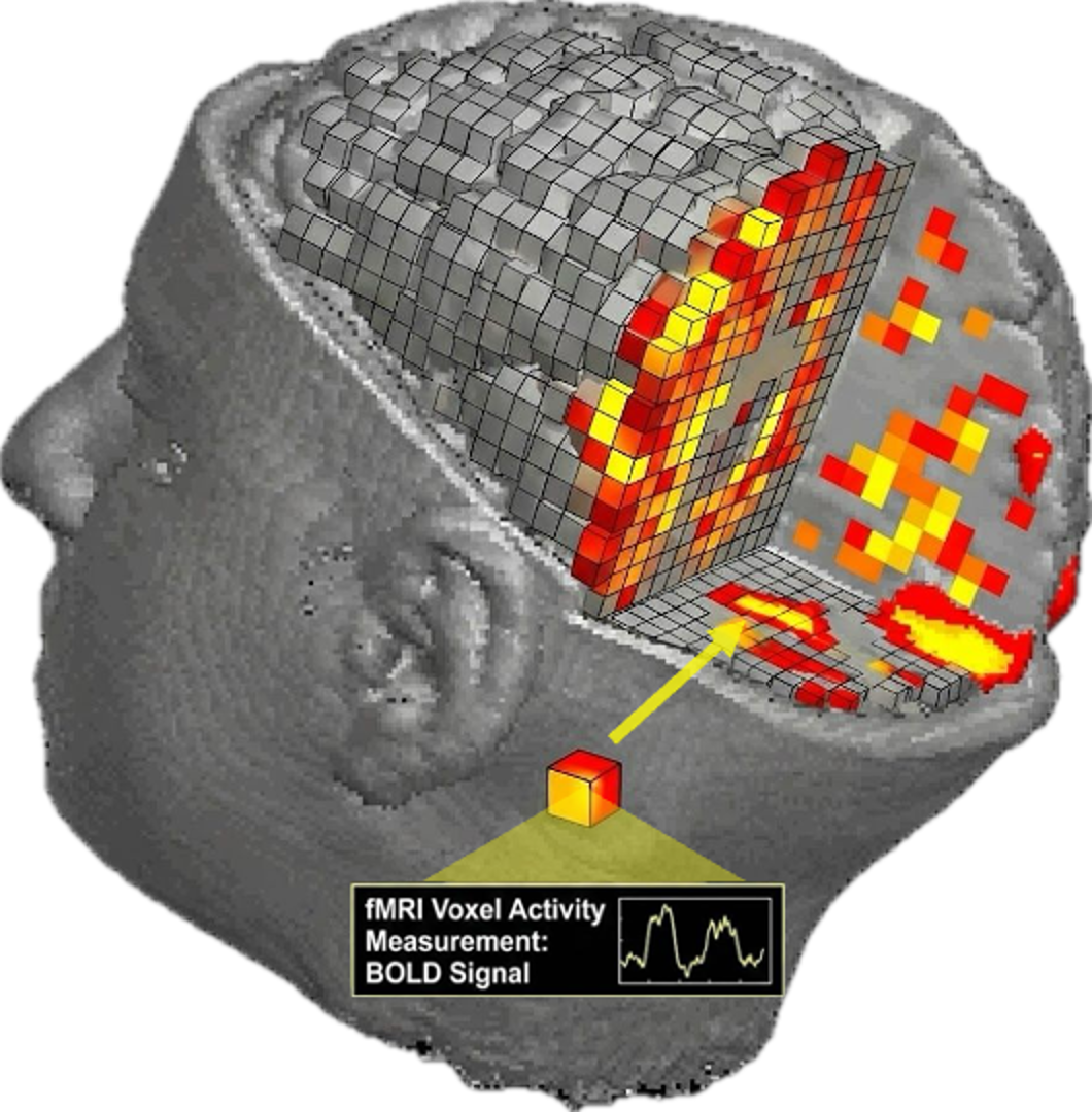 https://home.csulb.edu/~cwallis/482/fmri/fmri.html