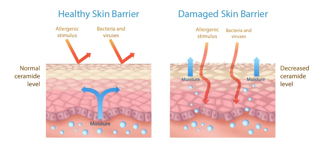 Rebuilding the Foundation of Healthy Skin: V Beauty Clinic’s Skin Barrier Program