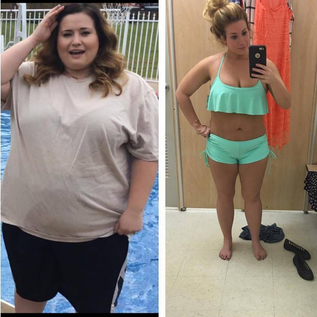 Похудел быстро форум. Сильно похудевшие люди как называется. Похудел быстро форум. Похудение до и после. Гербалайф для похудения до и после.