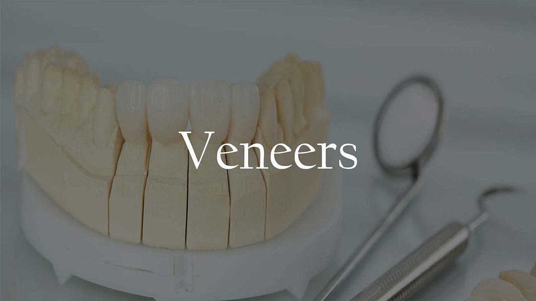 What Is The Procedure For Obtaining Porcelain Dental Veneers? by