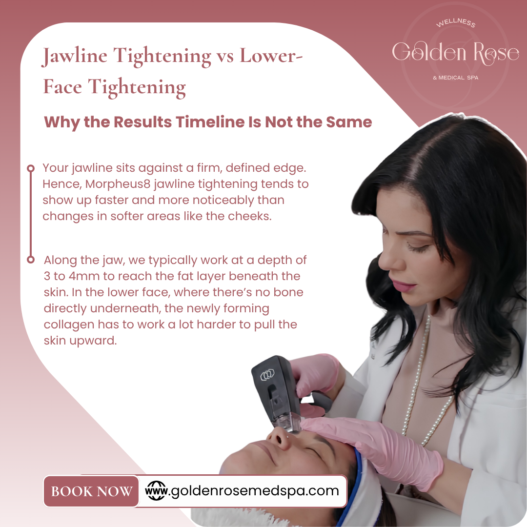 Safe Morpheus8 Skin Tightening in Apopka/Orlando, FL