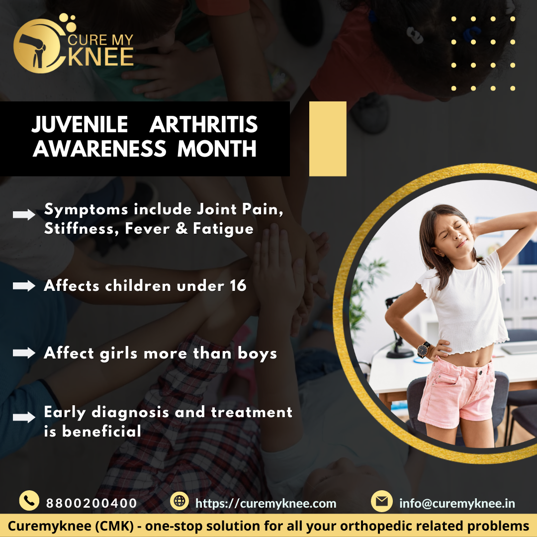 Arthritis Doctor In Delhi Cure My Knee Medium