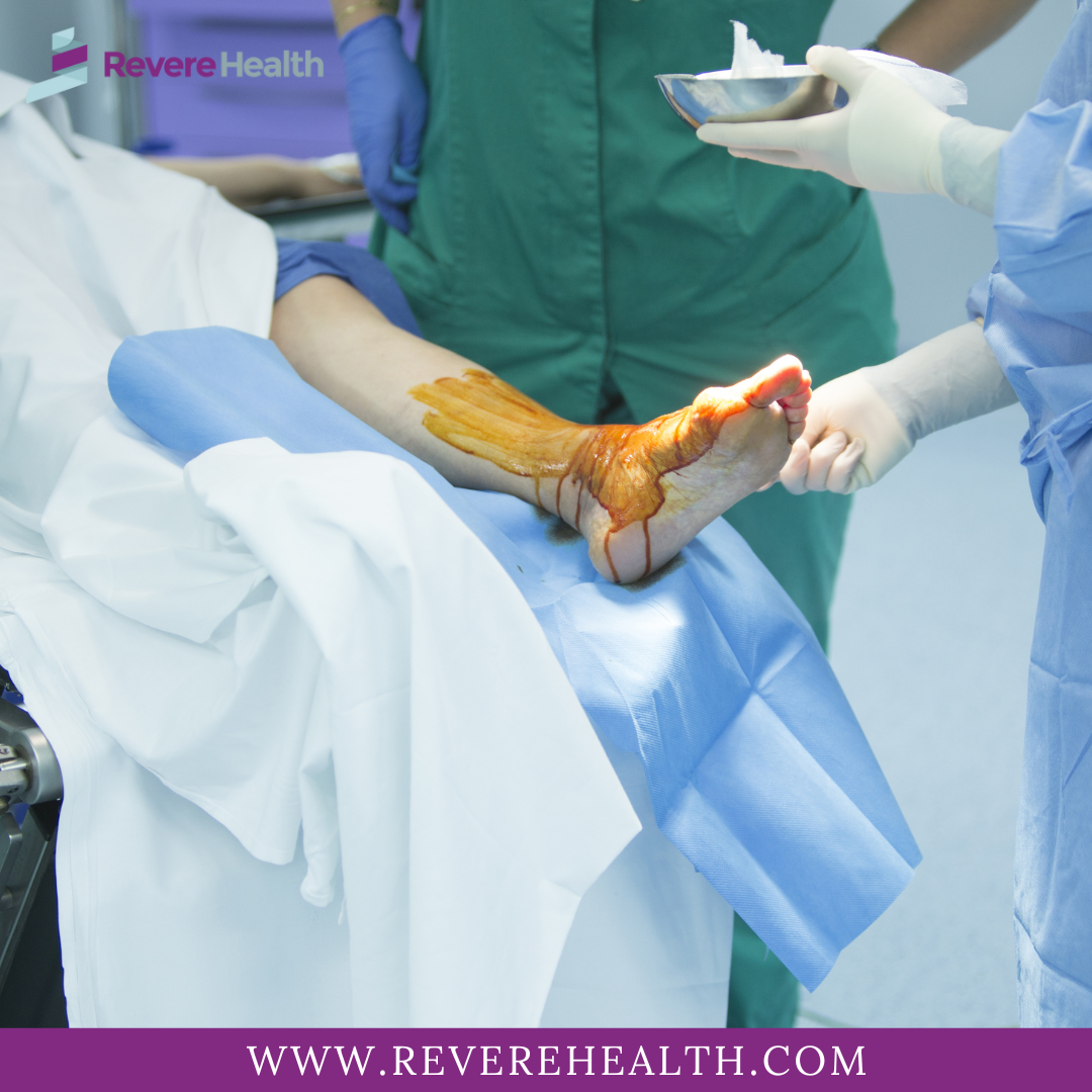 Orthopedic Surgeons Specializing in Foot and Ankle in Utah | Revere ...
