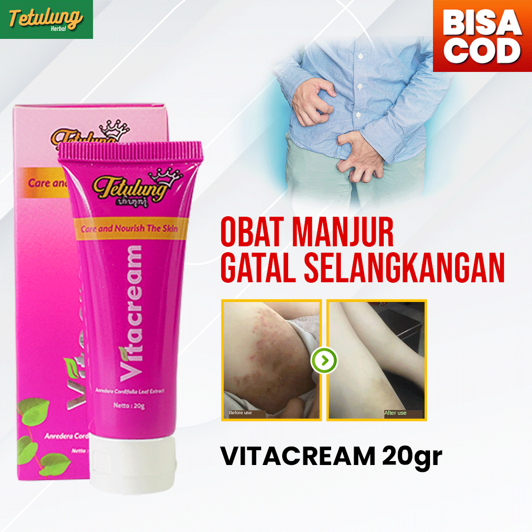 Jual Obat Salep Gatal Selangkangan Menahun Ampuh — Vitacream Sudah BPOM Denpasar