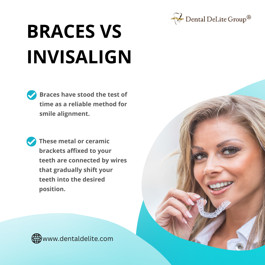 Aligning Your Smile Braces Vs Invisalign in Dallas & Duncanville, TX