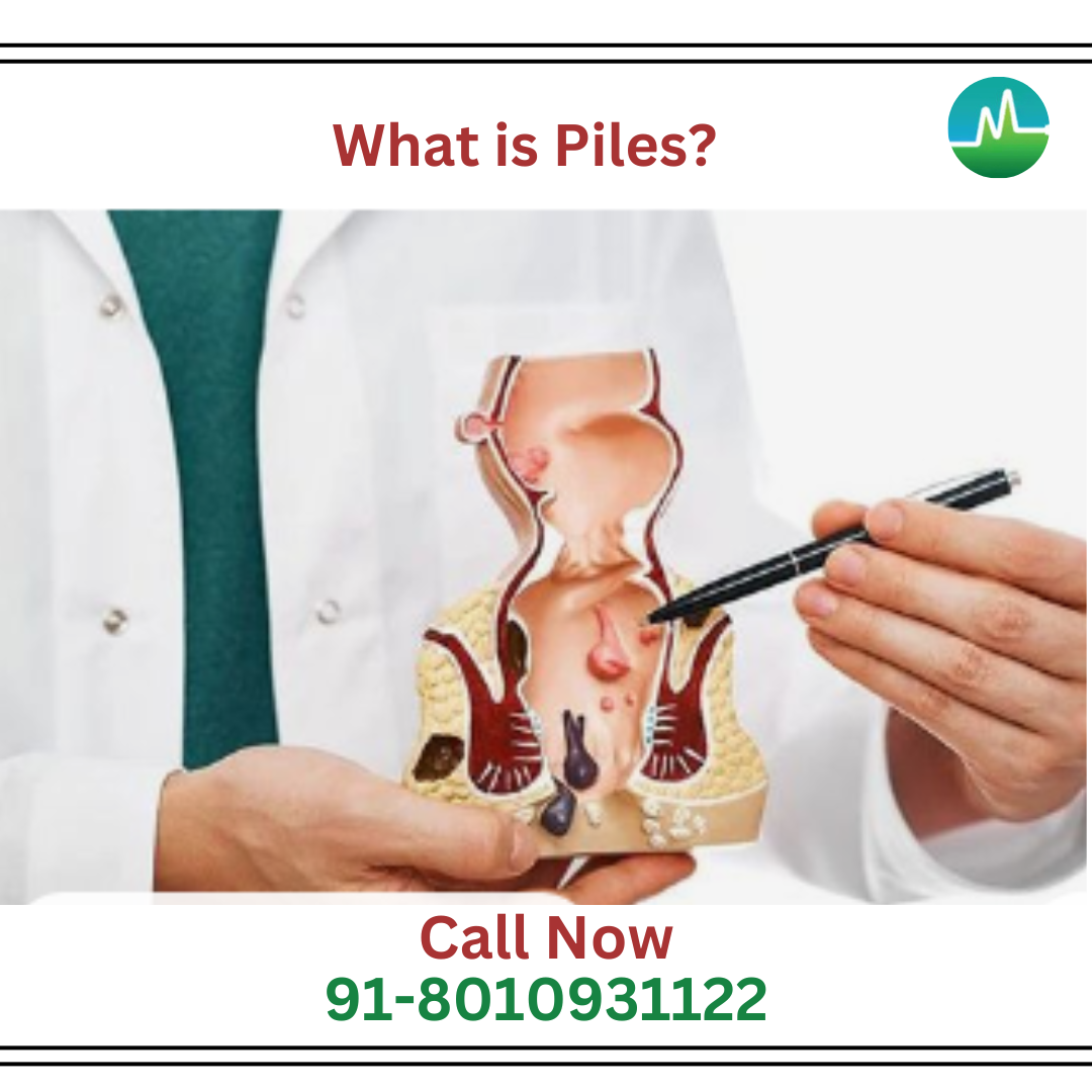 Ayurvedic Pile treatment in Badarpur without surgery by Dr Monga