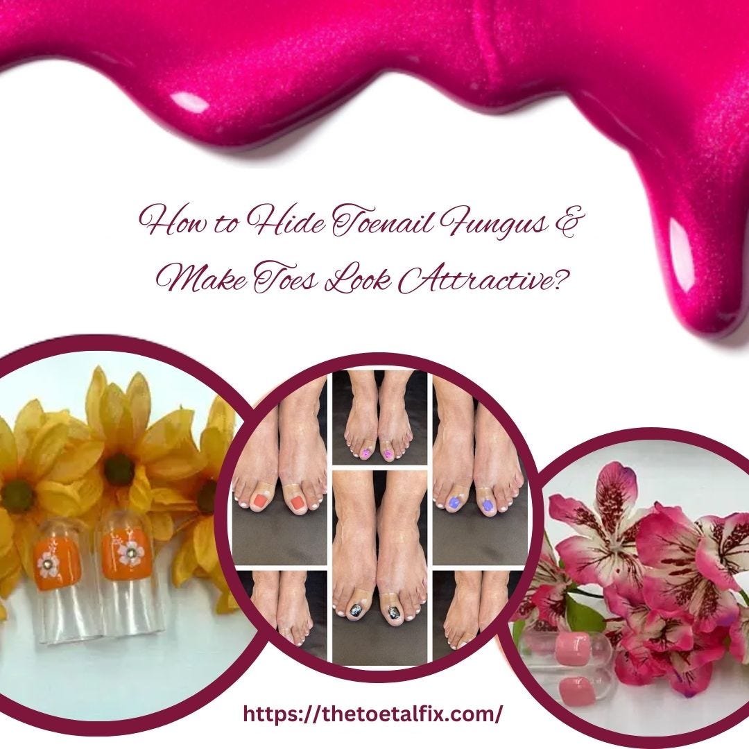 How to Hide Toenail Fungus & Make Toes Look Attractive? Medium