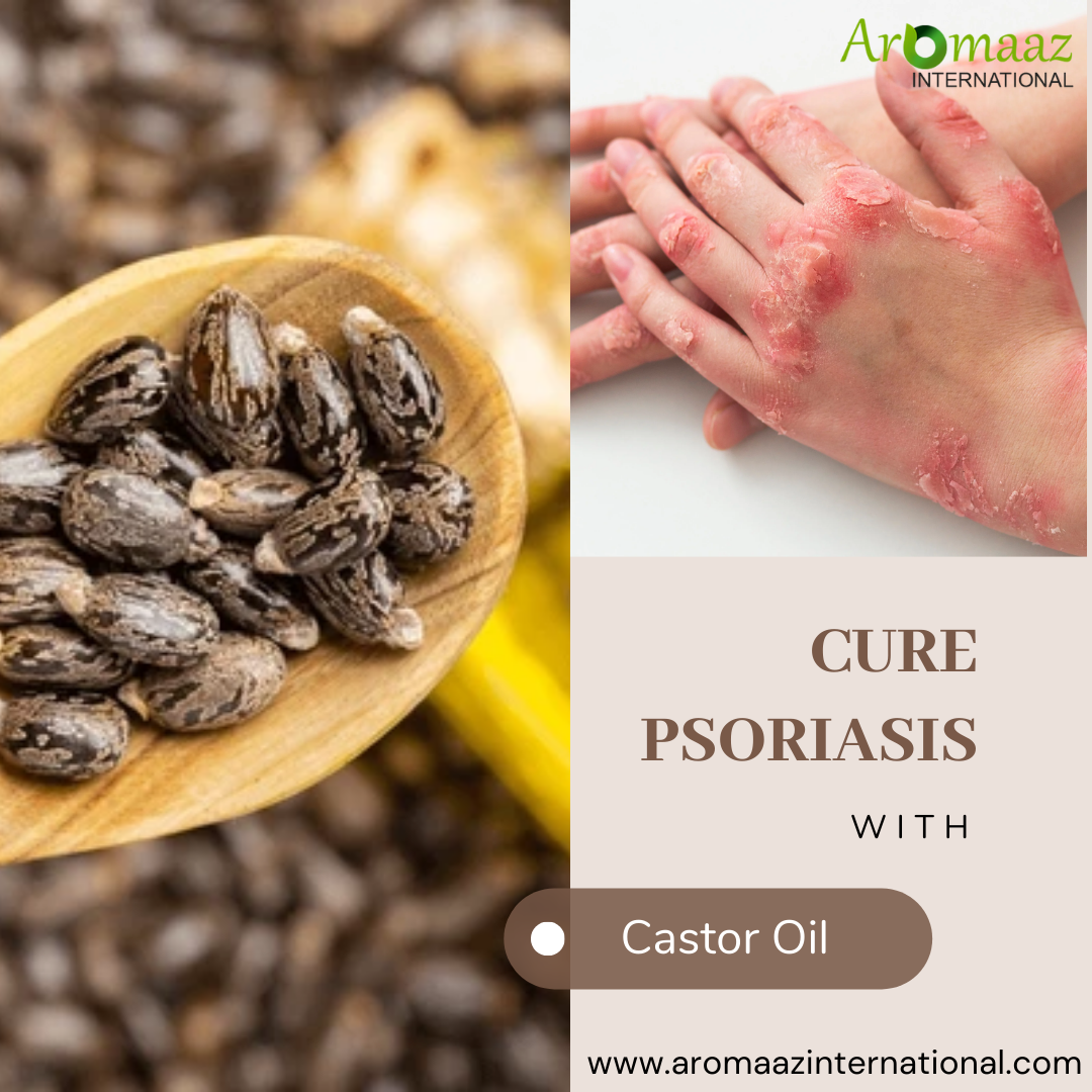 Castor Oil Provides Relief From Psoriasis Flare-ups - Aromaaz