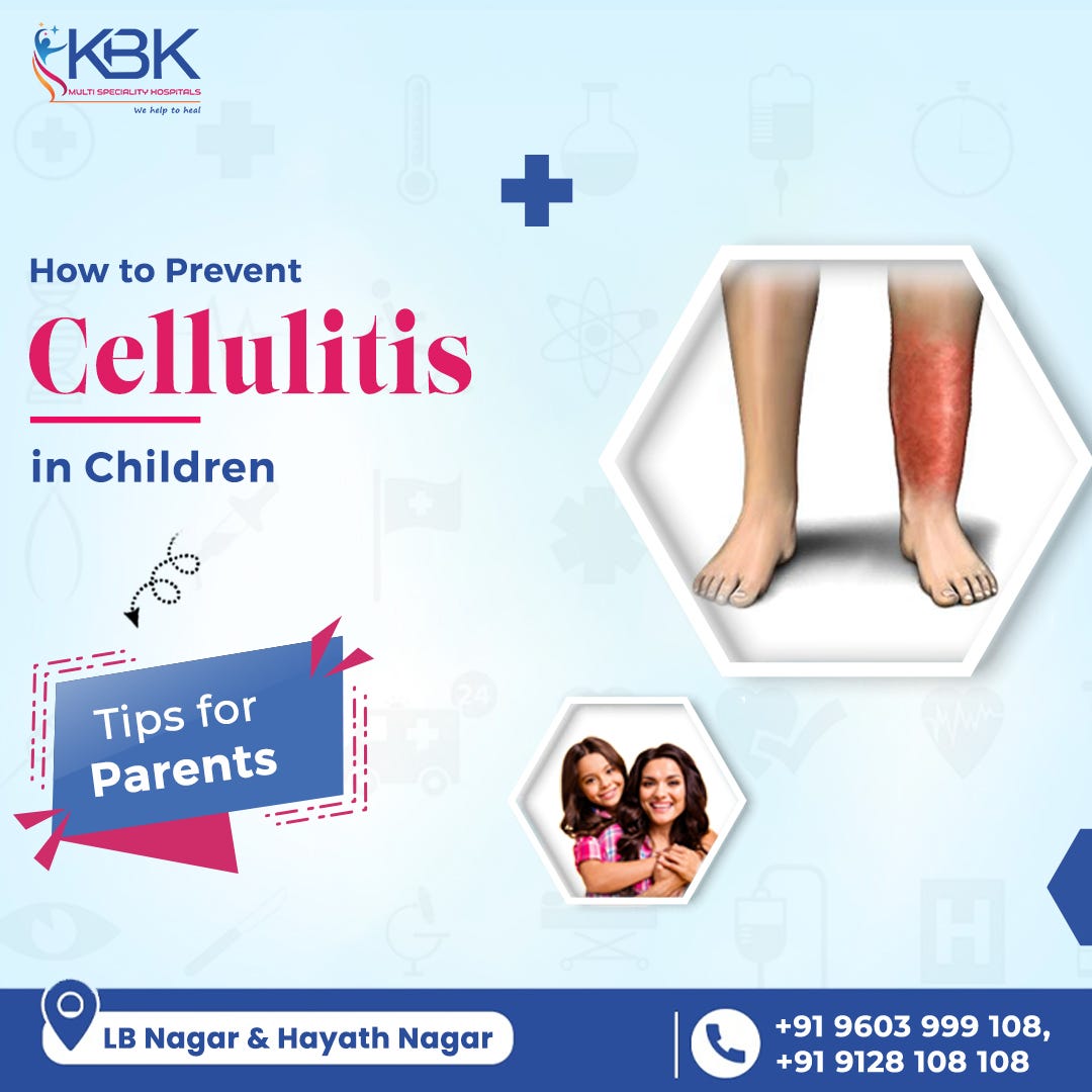 How To Prevent Cellulitis In Children Tips For Parents By KBK how-to-prevent-cellulitis-in-children-tips-for-parents-by-kbk
