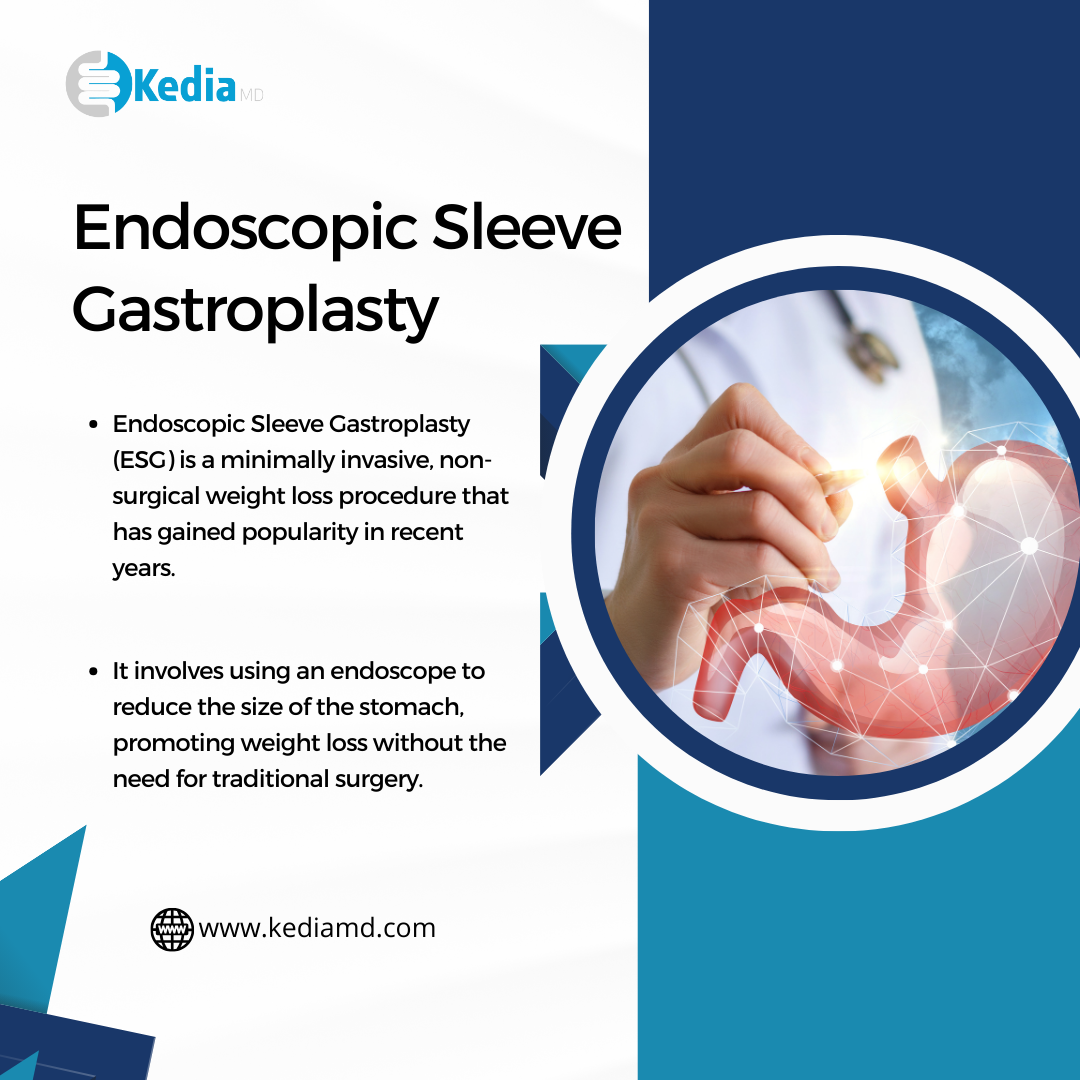 Transform Your Body with Endoscopic Sleeve Gastroplasty in Arlington