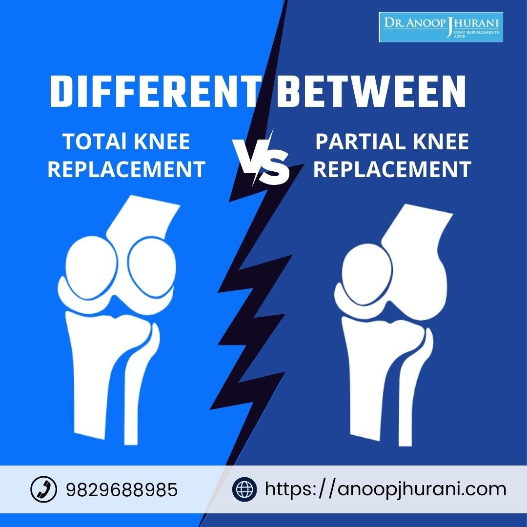 Difference Between Partial Total Knee Replacement By Dr Anoop Difference between partial total knee replacement by dr anoop
