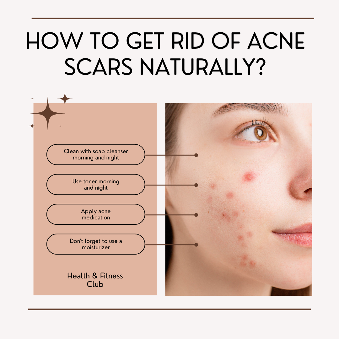 How To Get Rid Of ACNE SCARS Naturally? Mahdpk Medium