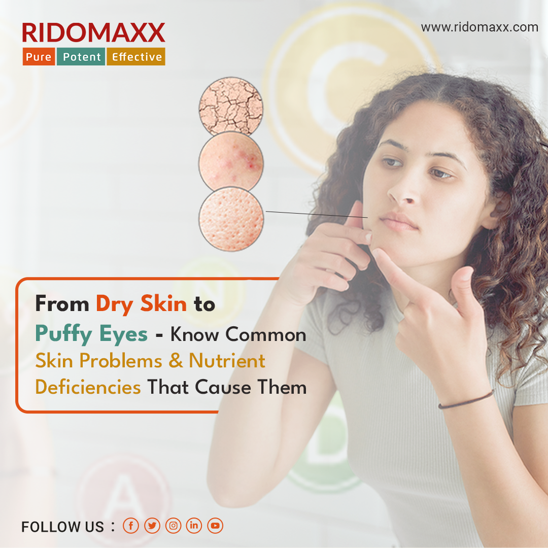 FROM DRY SKIN TO PUFFY EYES — KNOW COMMON SKIN PROBLEMS & NUTRIENT