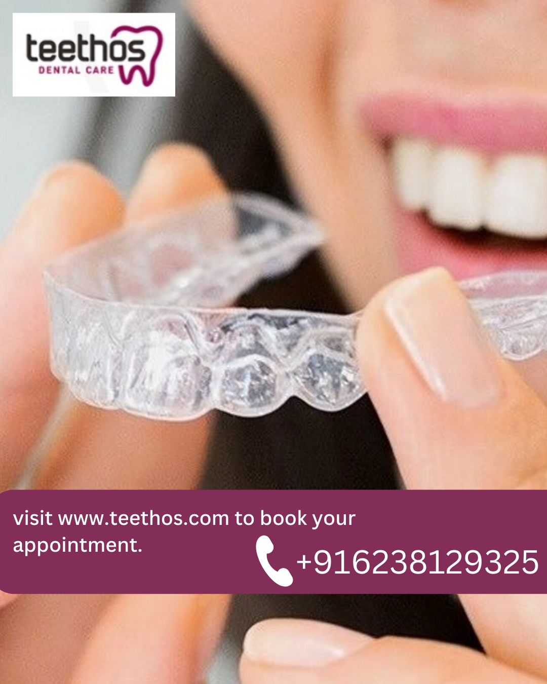 How much will my Invisalign clear aligners cost in Kerala?, by Teethos  Dental