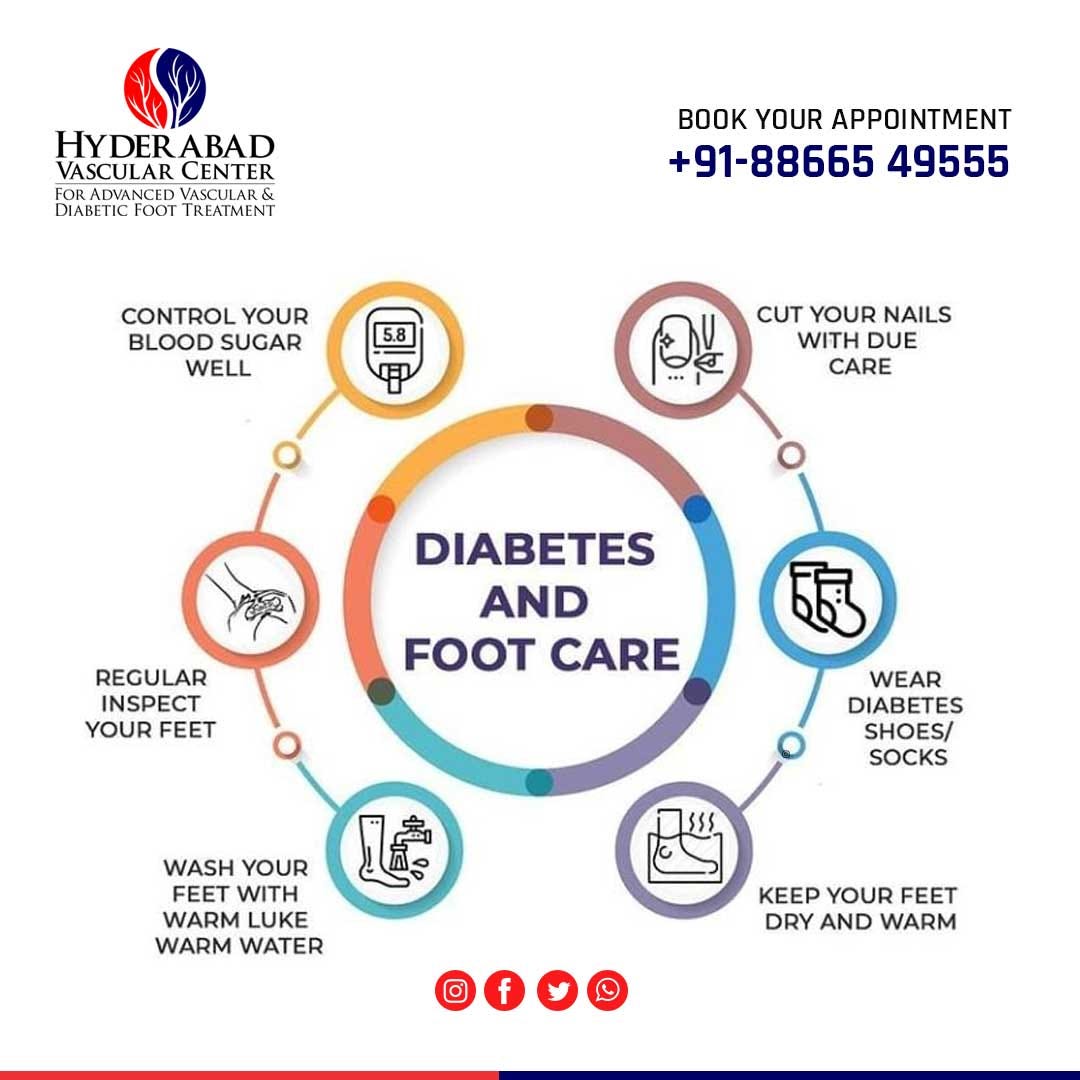 diabetic-foot-examination-why-it-is-important-and-what-you-should-know