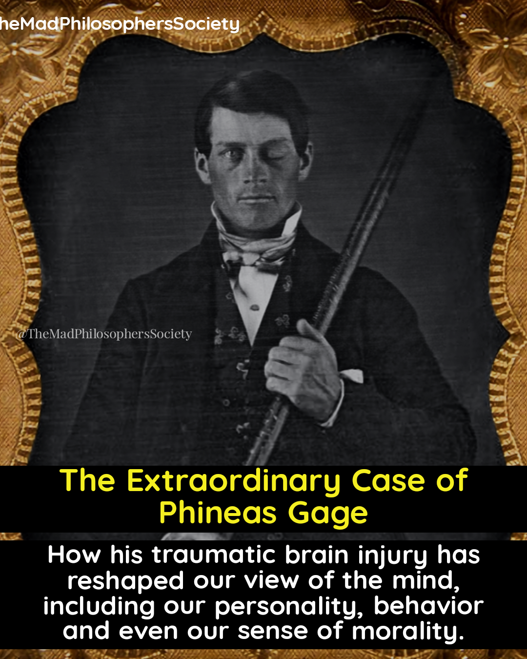 The Story of Phineas Gage -. The Extraordinary Case of Phineas Gage ...