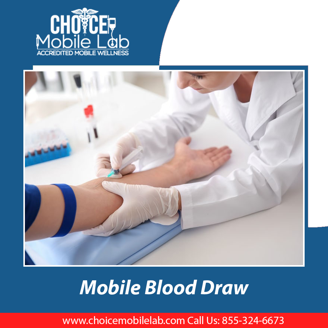 What to Know About a Mobile Phlebotomist by Choice mobile Lab Medium