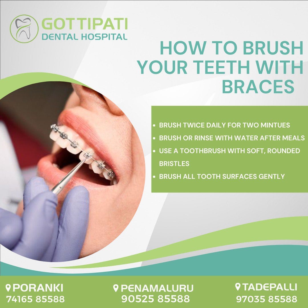 BEST DENTAL CARE How to brush your teeth with Braces? For More Detail
