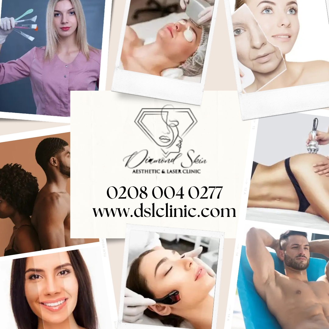 Achieve Smooth, Hair-Free Skin with Laser Hair Removal London | by Diamond  Skin Aesthetic and Laser Clinic | Medium