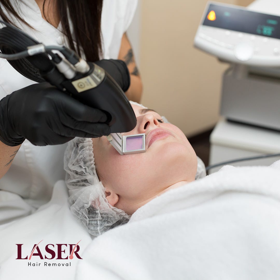 Upper lips Laser Hair Removal. Laser Hair Removal Medical Center is