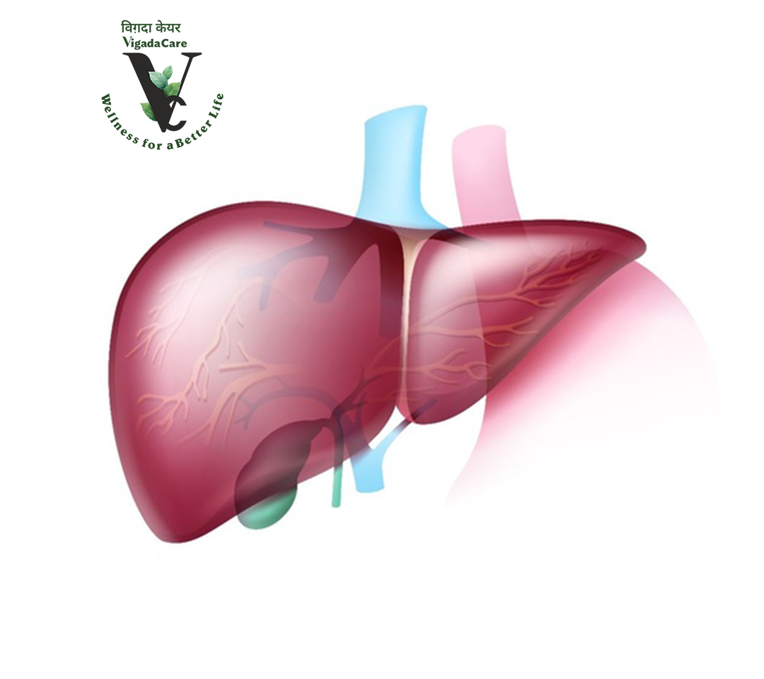 How Can I Reduce Bilirubin Levels In My Body? by Vigada Care Aug