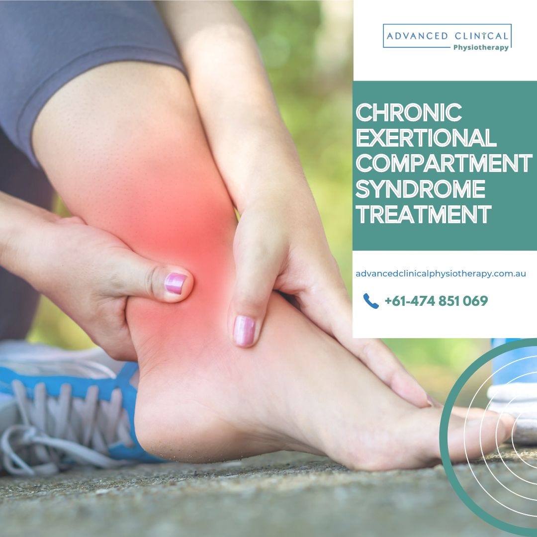 Chronic Exertional Compartment Syndrome Treatment Advanced Clinical