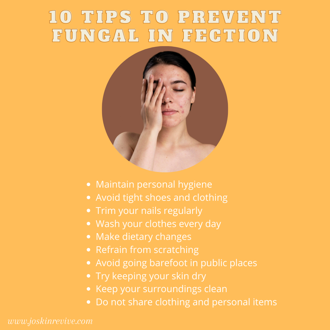 10 Tips to prevent Fungal Infections by Skinreviveclinic Medium