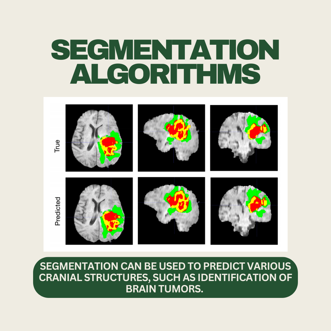 ELIF The Dice Similarity Coefficient by Britney The Medium