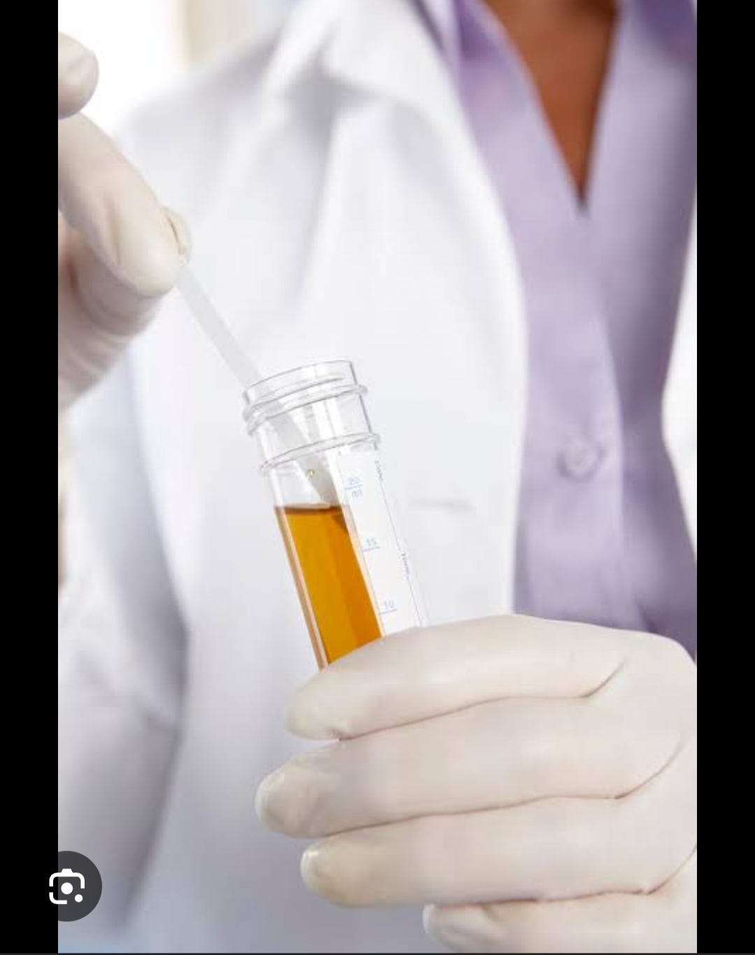 HOW DO I GET A MIDSTREAM URINE? by Scientist Gift Nwodo May, 2024