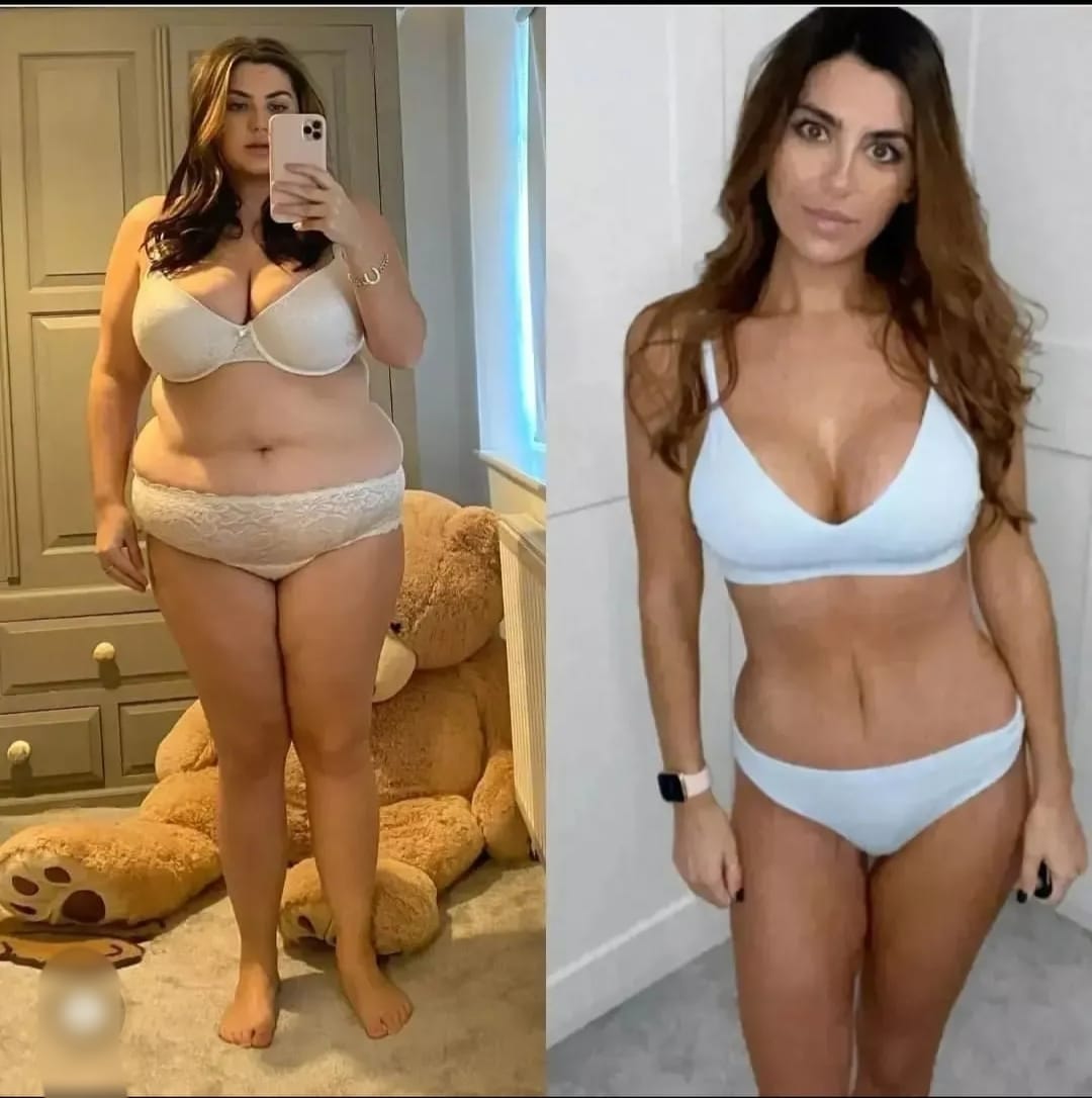 How To Get Rid Of Loose Skin After Weight Loss by Regina turnbull Medium