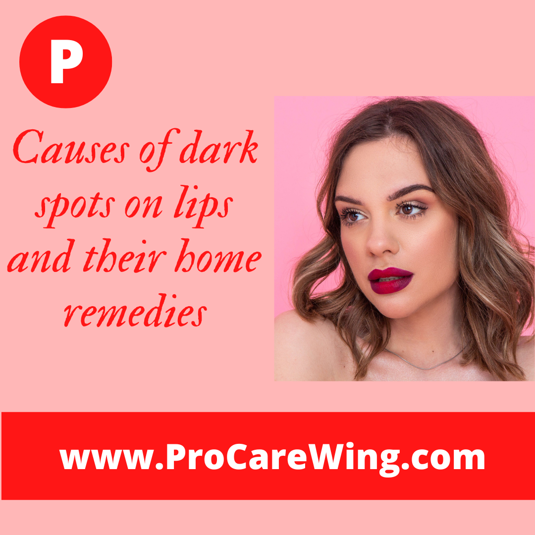 Causes of dark spots on lips and their home remedies by procarewing