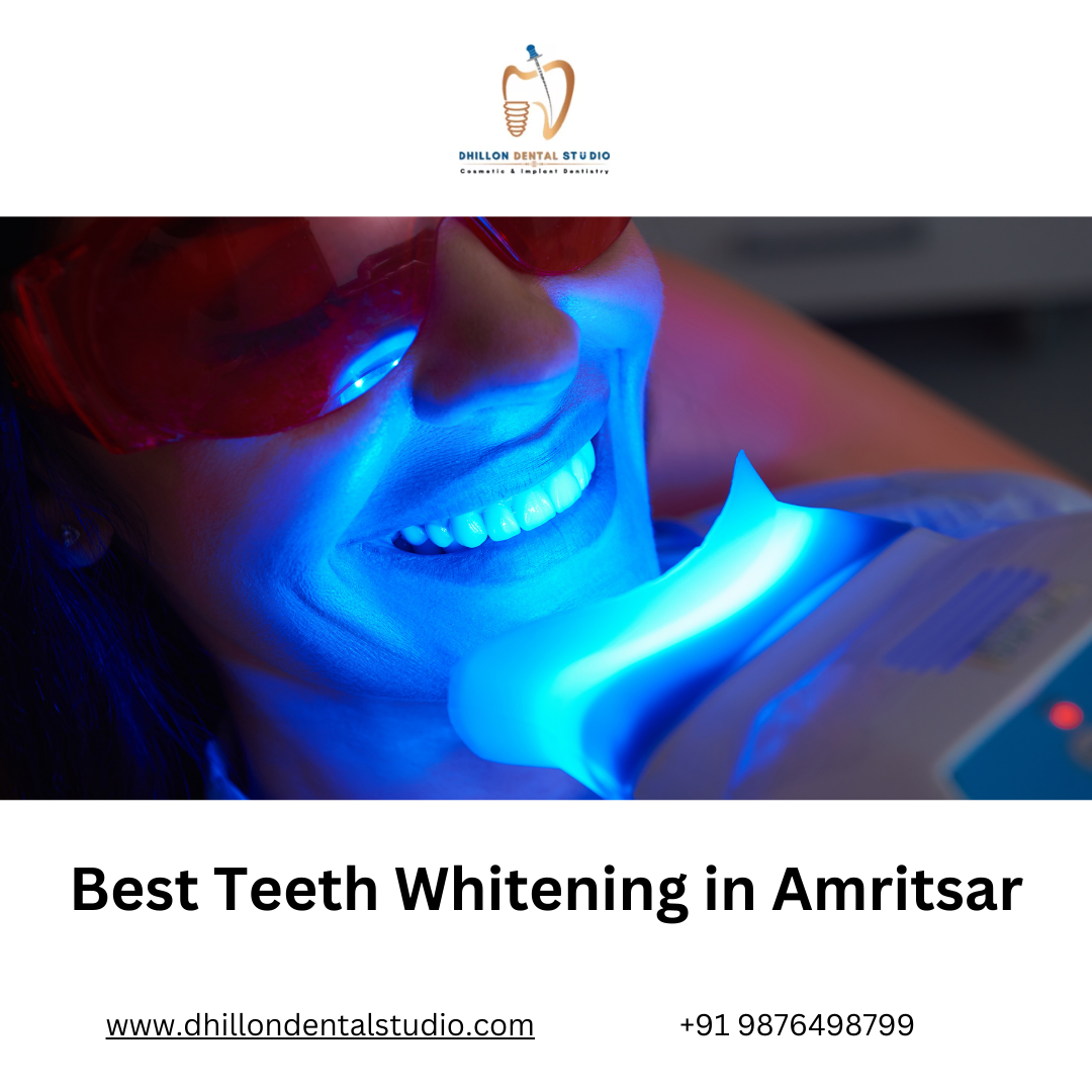 Ultimate Guide to Achieving a Radiant Smile Best Teeth Whitening Practices in Amritsar by