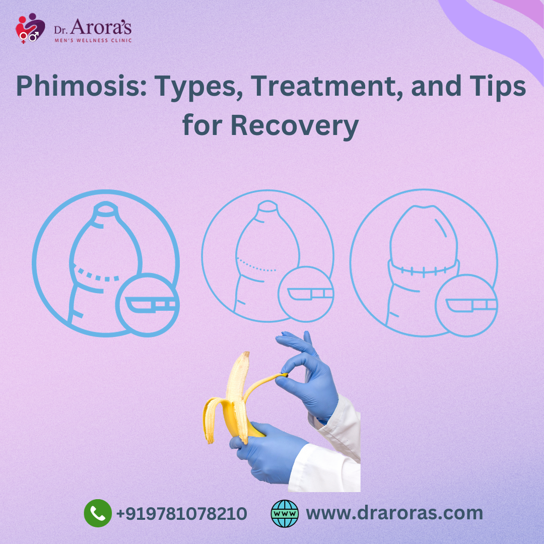 Understanding Phimosis: Types, Treatment, and Tips for Recovery, by  Aroradrarun, Dec, 2023