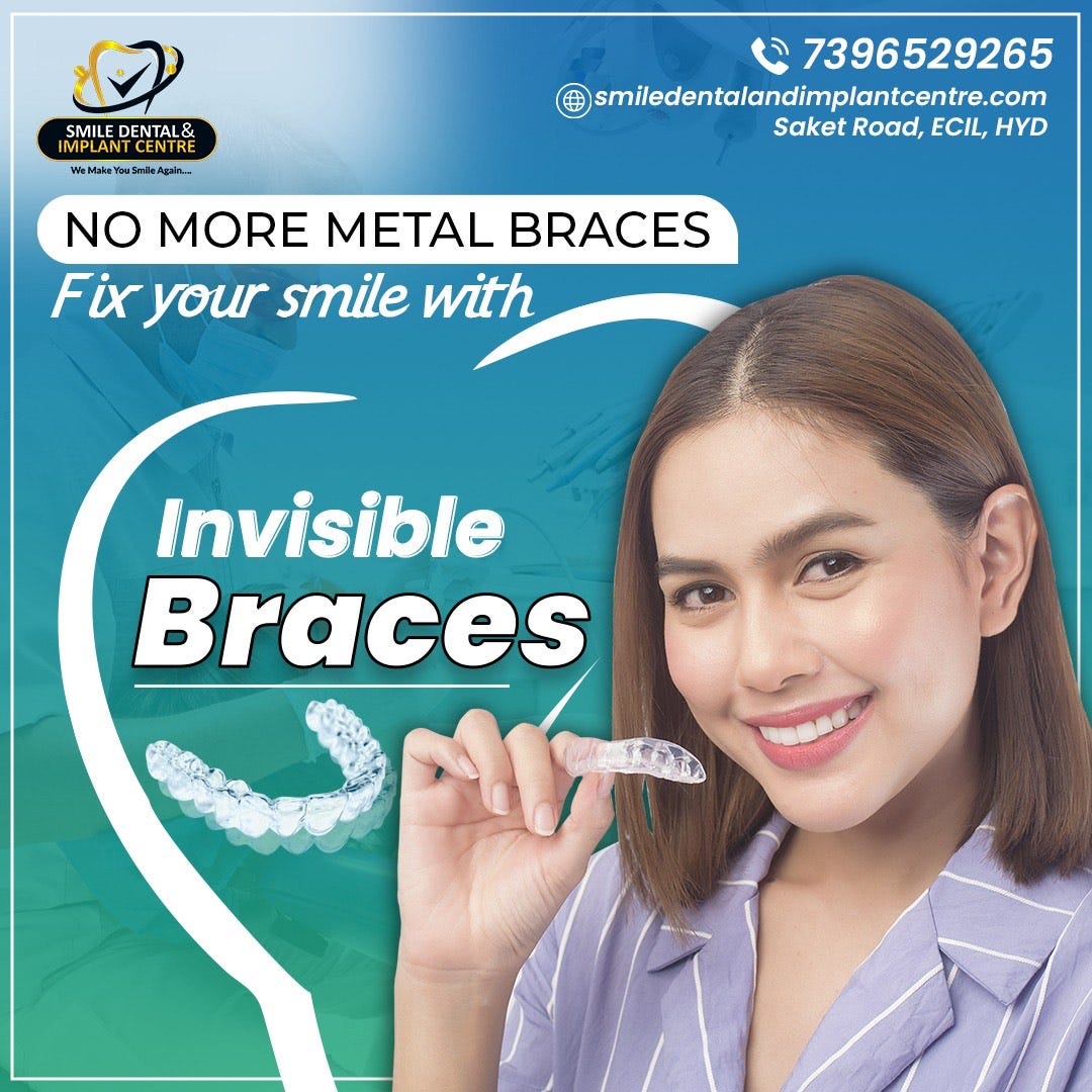 What Are the Benefits of Invisible Braces, Smile Dental and Implant Centre, by Smile Dental and Implant Centre