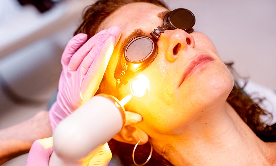 Achieve Clearer Skin with Laser Acne Treatment