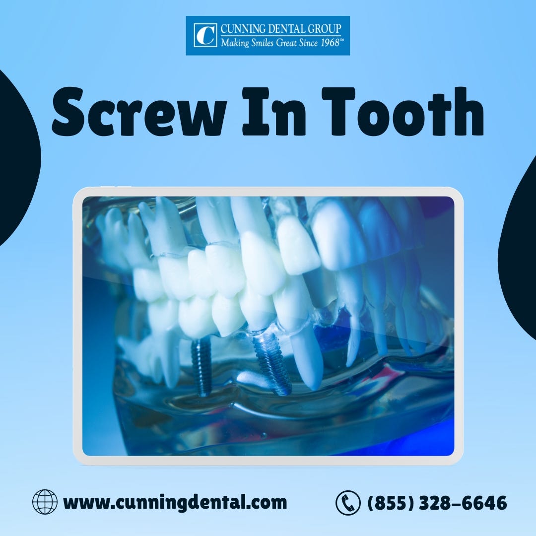 Screwin Teeth and Denture Implants Cunning Dental Group Medium