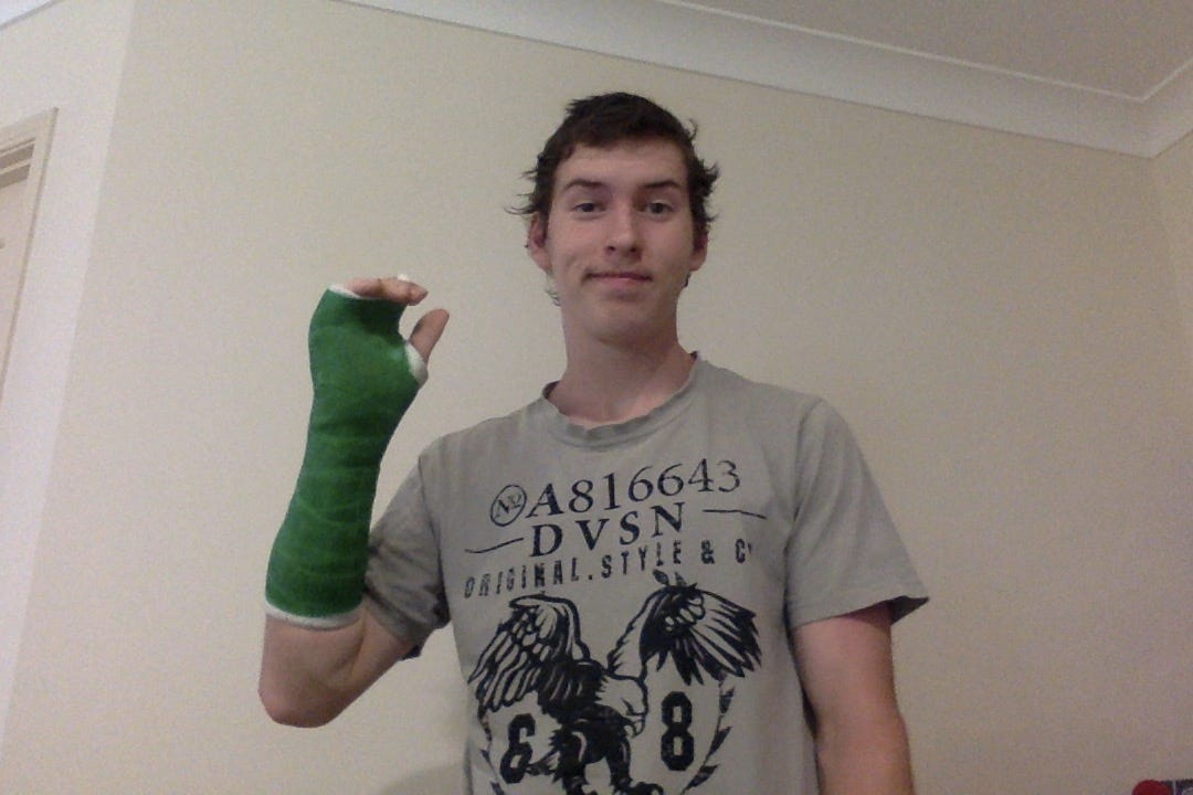 Coding with a Broken Hand. Yeah, had to go through it, by Jack Glendenning