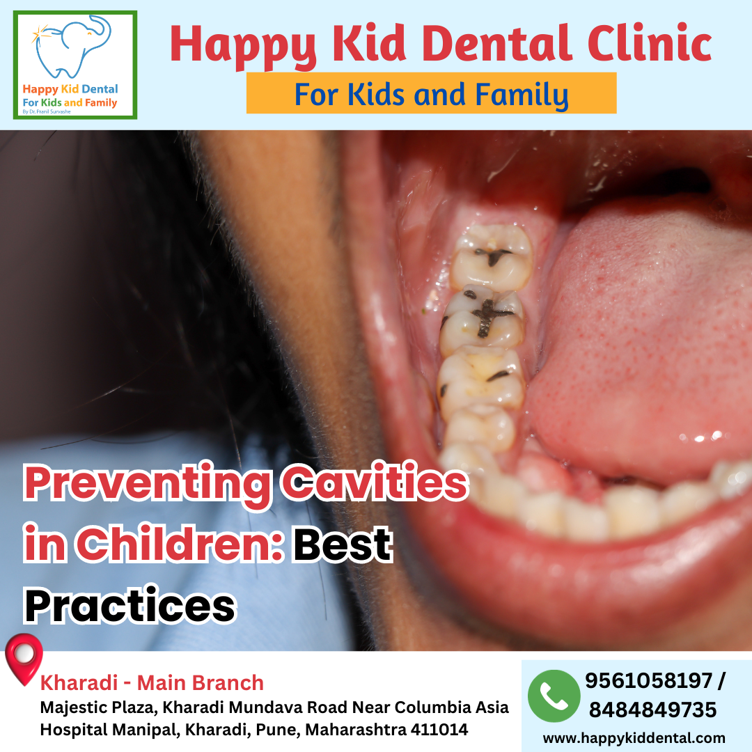 Preventing cavities Children Dentist in Kharadi, Pune Dr. Pranil