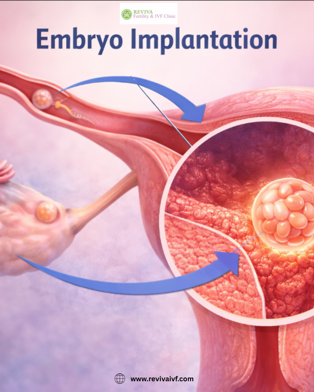 Embryo Implantation in Chandigarh